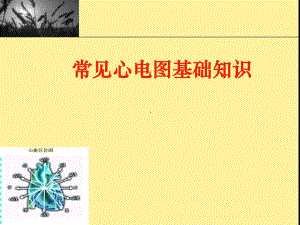 常见心电图基础知识.ppt