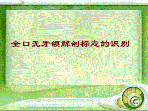 全口无牙颌解剖标志的识别.ppt