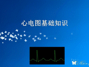心电图基础知识1.ppt