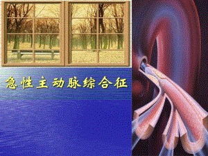 急性主动脉综合征.ppt
