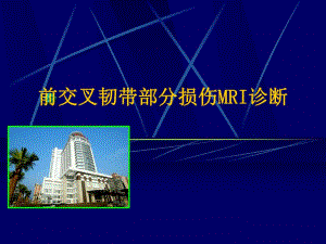 前交叉韧带部分损伤MRI诊断.ppt