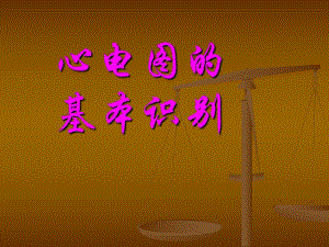 快速心电图入门.ppt