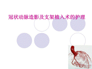 冠脉造影及支架植入术的护理.ppt