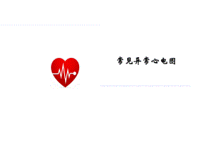 常见异常心电图(修改版).ppt