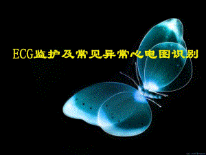ECG监护及常见异常心电图的识别.ppt