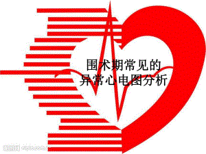 围术期常见的异常心电图分析.ppt