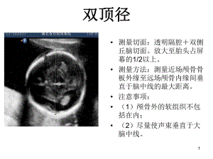 产科超声标准切面25张图.ppt