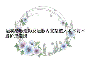 冠脉造影护理CAG.ppt