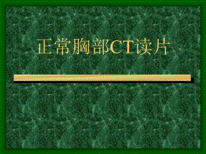 正常胸部CT读片.ppt