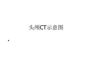 脑头颅CT示意图.ppt