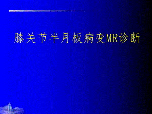 膝关节半月板MR.ppt