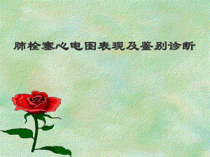 肺栓塞心电图表现及鉴别诊断.ppt