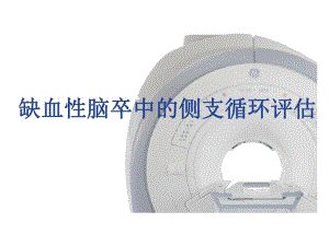 缺血性脑卒中的侧支循环评估.ppt