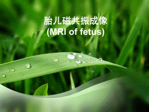 胎儿磁共振成像.ppt