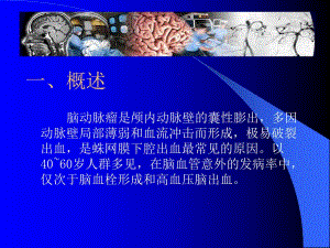 颅内动脉瘤.ppt