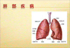 肺部疾病.ppt.ppt