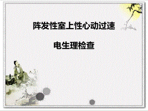阵发性室上性心动过速.ppt