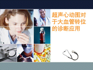 超声心动图中节段法对于大血管转位的诊断应用.ppt