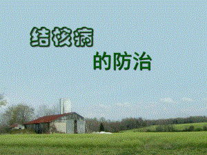 结核病防治知识课件.ppt