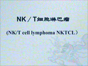 NK／T细胞淋巴瘤.ppt