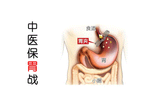 中医保胃战专题培训.ppt