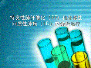 特发性肺间质纤维化.ppt