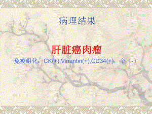 肝脏肿瘤.ppt