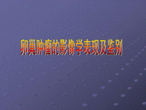 卵巢肿瘤的影像学表现幻灯片.ppt