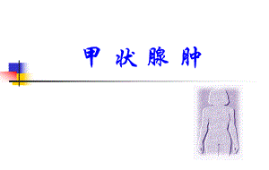 甲状腺肿.ppt