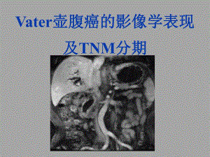Vater壶腹癌的影像学表现及TNM分期.ppt