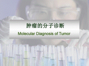 肿瘤诊断.ppt