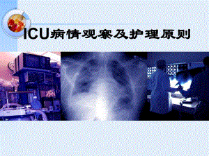 ICU病情观察及护理原则.ppt