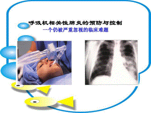 呼吸机相关性肺炎的预防与控制.ppt