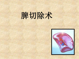 脾切除术.ppt