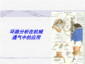 波形分析在机械通气的应用.ppt