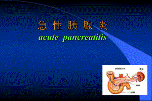 急性胰腺炎.ppt