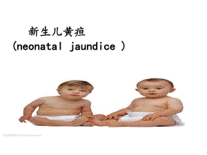 新生儿黄疸护理ppt.ppt
