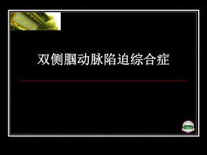 双侧腘动脉陷迫综合症.ppt