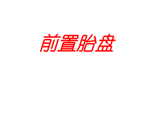 医院妇产科培训资料前置胎盘认识与学习培训PPT.ppt