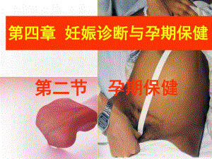 【精品PPT】妊娠诊断与孕期保健.ppt
