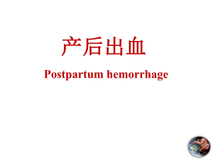 产后出血.ppt