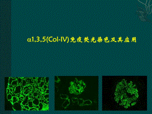 肾脏病理.ppt