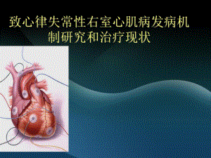 致心律失常性右室心肌病.ppt.ppt