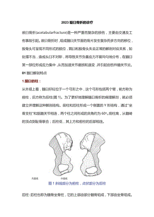 2023髋臼骨折的诊疗.docx