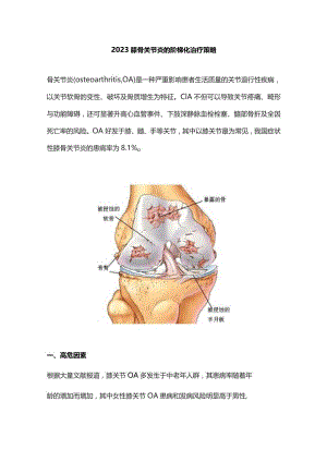 2023膝骨关节炎的阶梯化治疗策略.docx