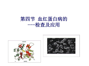 血红蛋白病和免疫性溶血性贫血检查.ppt