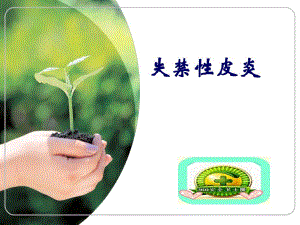 失禁性皮炎护理.ppt