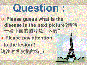 带状疱疹课件.ppt