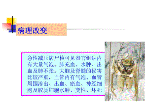 [临床医学]高压氧治疗培训PPT下.ppt