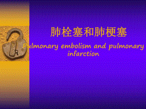 肺栓塞和肺梗塞.ppt.ppt